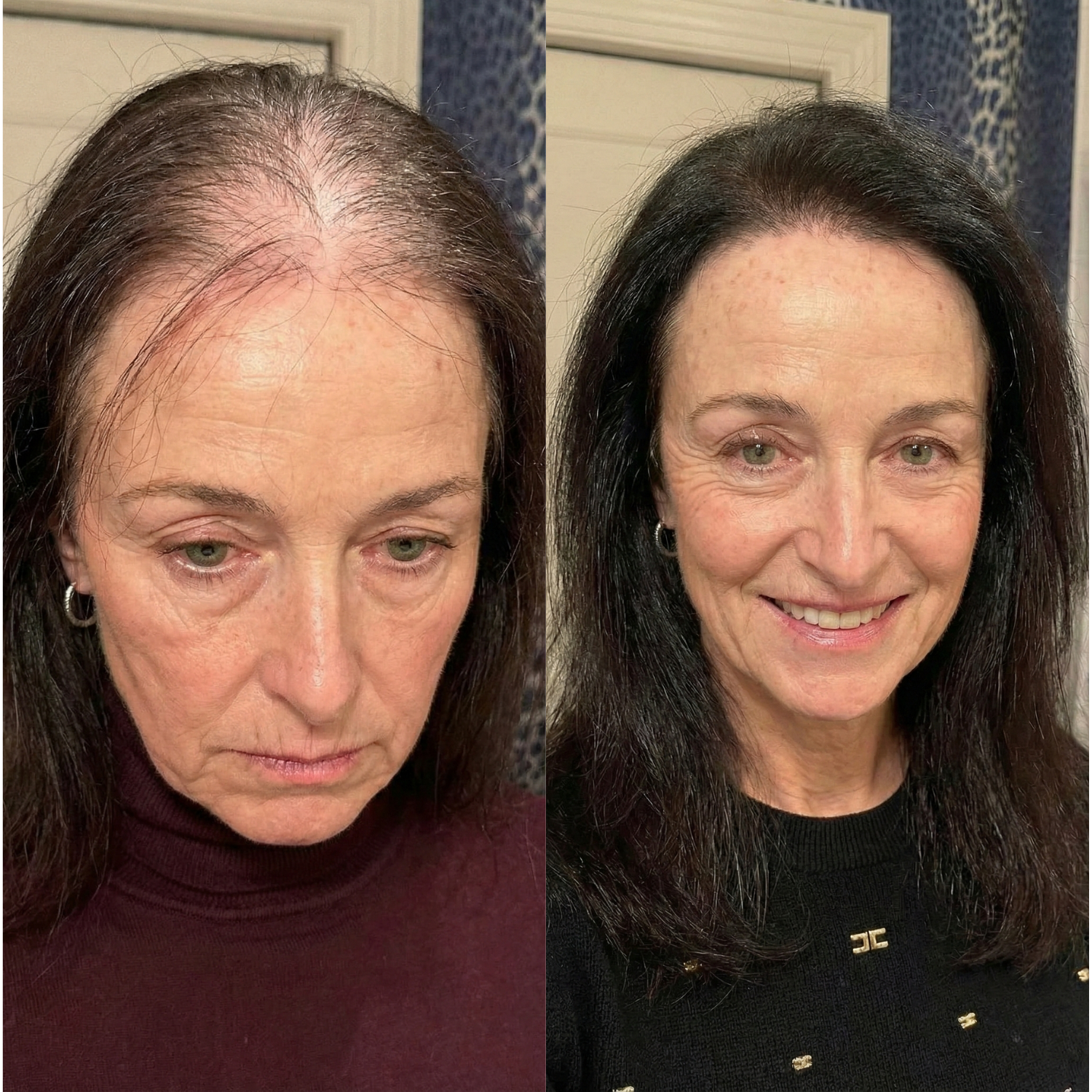 Scalp Activating Serum